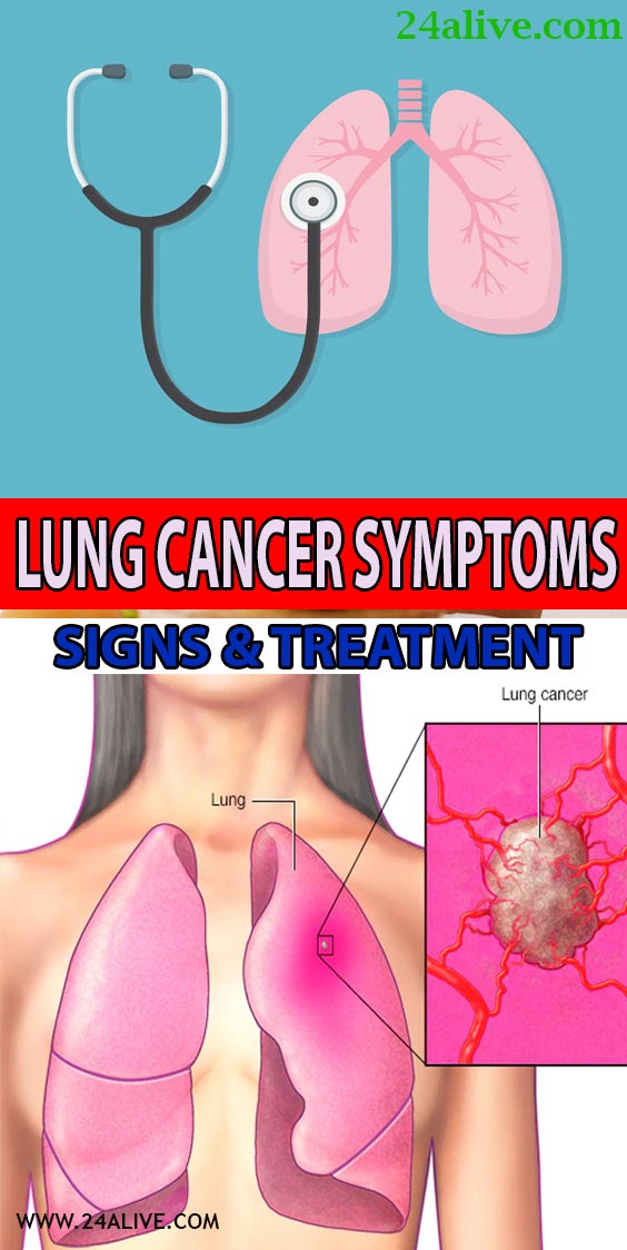 Lung Cancer Symptoms Signs Treatment