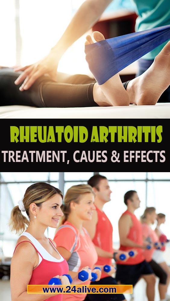 RHEUMATOID-ARTHRITIS-TREATMENT
