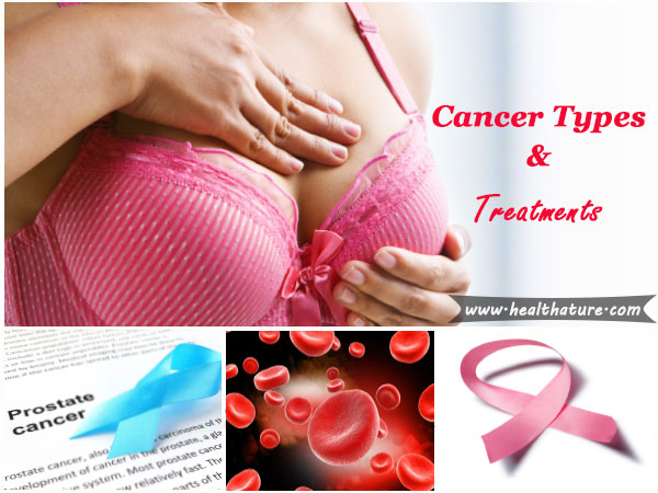 Treatment for Cancer